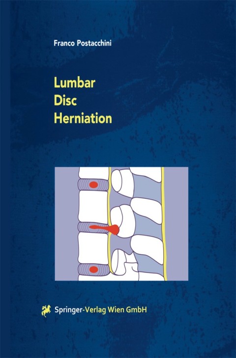 Cover image for book Lumbar Disc Herniation