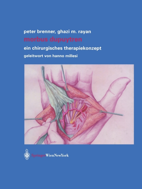 Cover image for book Morbus Dupuytren