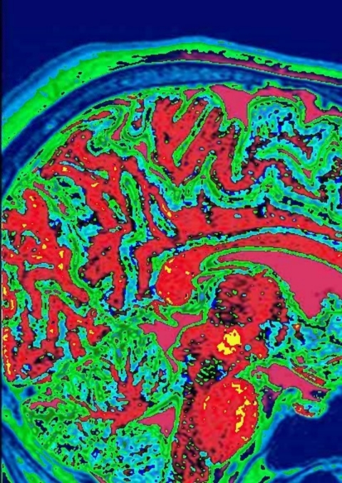 Cover image for book Clinical Pharmacology of Sleep