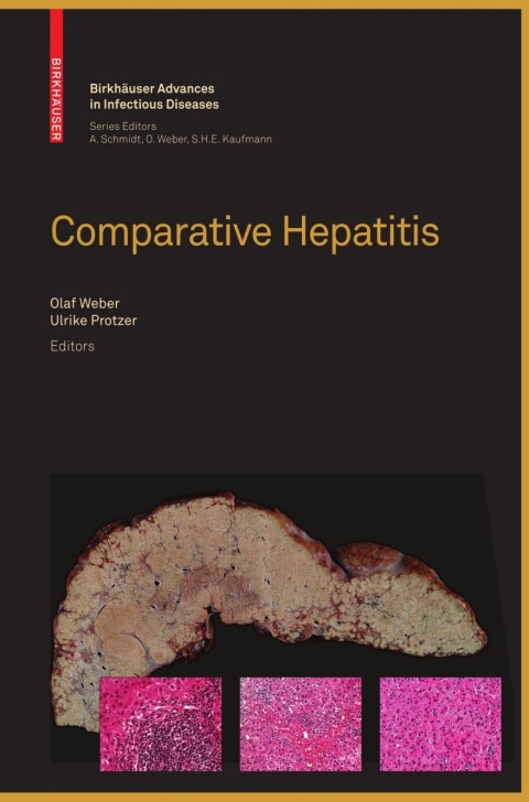 Cover image for book Comparative Hepatitis