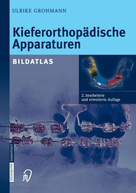 Cover image for book Kieferorthopädische Apparaturen