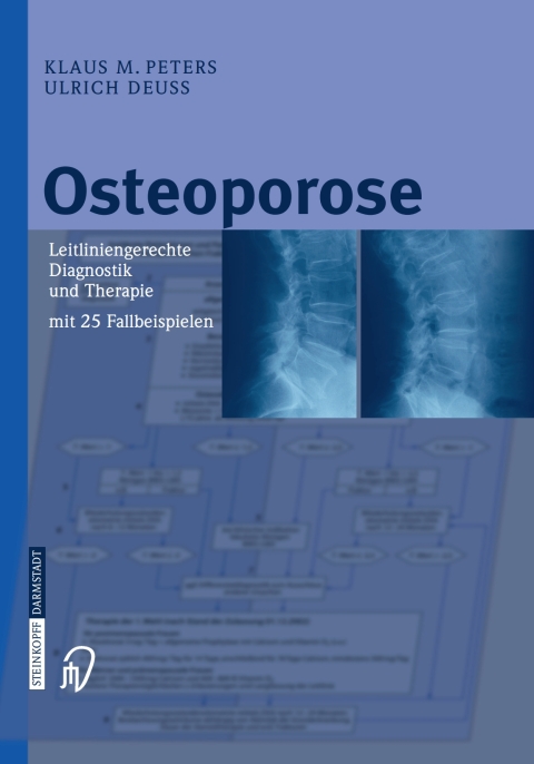 Cover image for book Osteoporose
