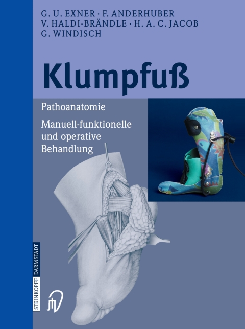 Cover image for book Klumpfuß