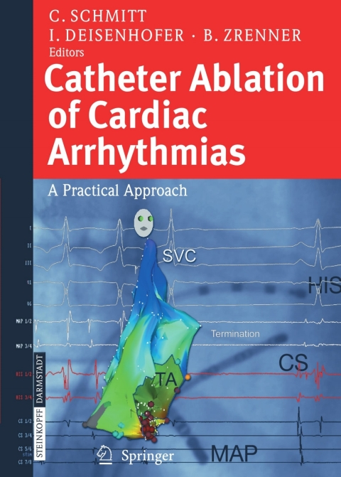 Cover image for book Catheter Ablation of Cardiac Arrhythmias