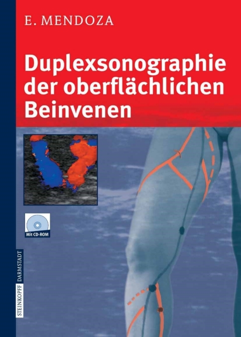 Cover image for book Duplexsonographie der oberflächlichen Beinvenen