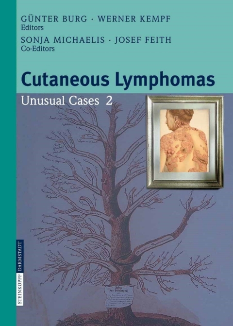 Cover image for book Cutaneous Lymphomas