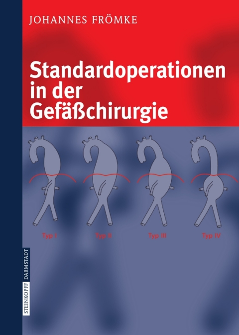 Cover image for book Standardoperationen in der Gefäßchirurgie