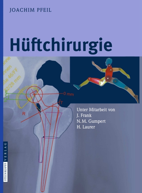 Cover image for book Hüftchirurgie