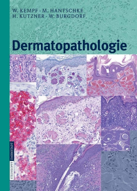 Cover image for book Dermatopathologie
