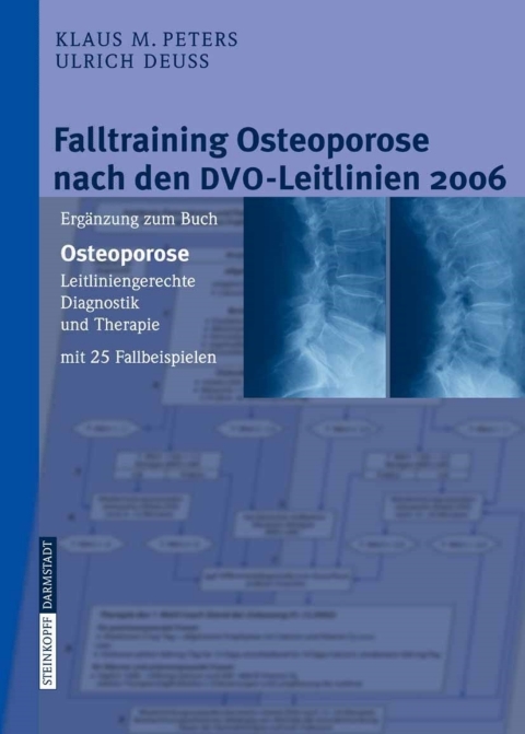 Cover image for book Falltraining Osteoporose nach den DVO-Leitlinien 2006