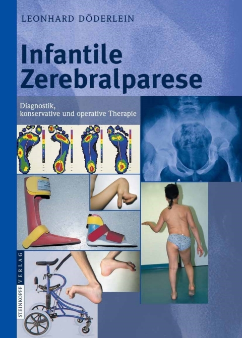 Cover image for book Infantile Zerebralparese