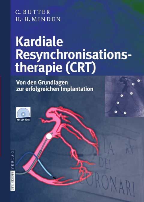 Cover image for book Kardiale Resynchronisationstherapie (CRT)