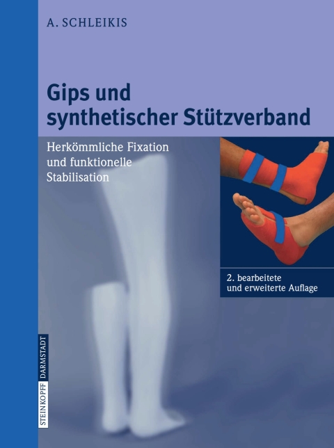 Cover image for book Gips und synthetischer Stützverband