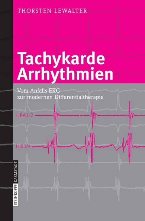 Cover image for book Tachykarde Arrhythmien