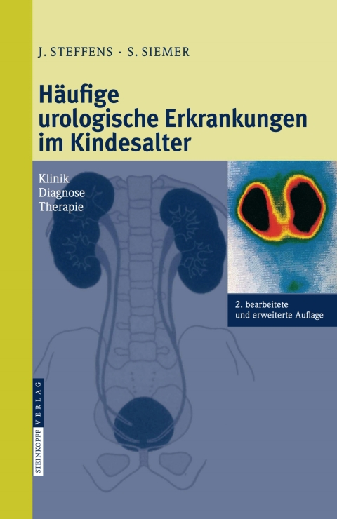 Cover image for book Häufige urologische Erkrankungen im Kindesalter