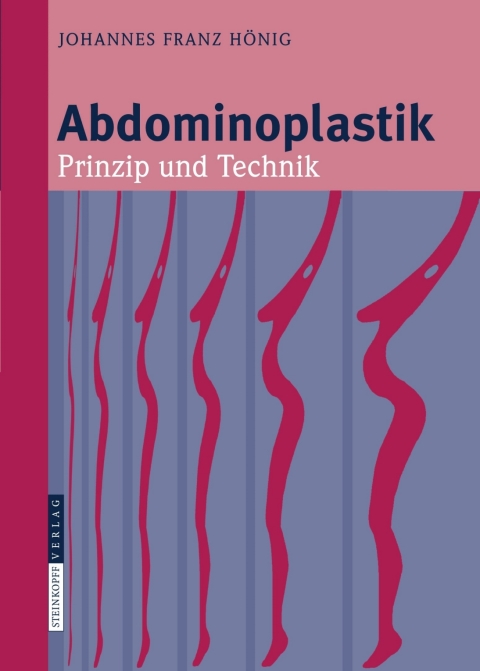 Cover image for book Abdominoplastik