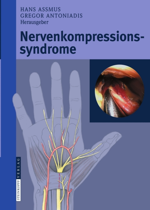 Cover image for book Nervenkompressionssyndrome