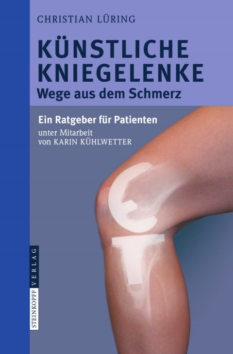 Cover image for book Künstliche Kniegelenke