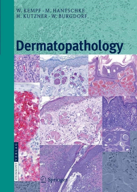 Cover image for book Dermatopathology