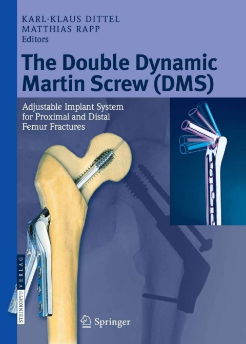Cover image for book The Double Dynamic Martin Screw (DMS)