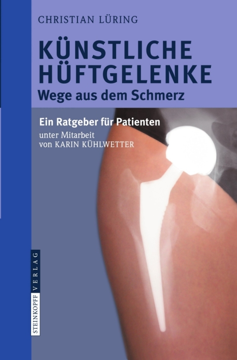 Cover image for book Künstliche Hüftgelenke