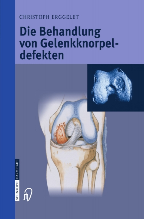 Cover image for book Die Behandlung von Gelenkknorpeldefekten