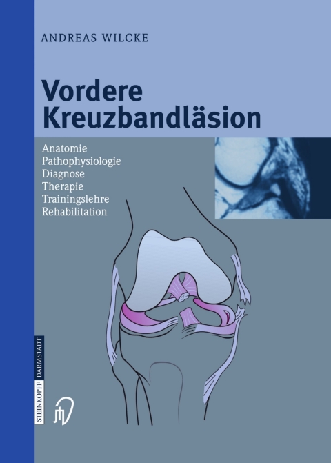 Cover image for book Vordere Kreuzbandläsion