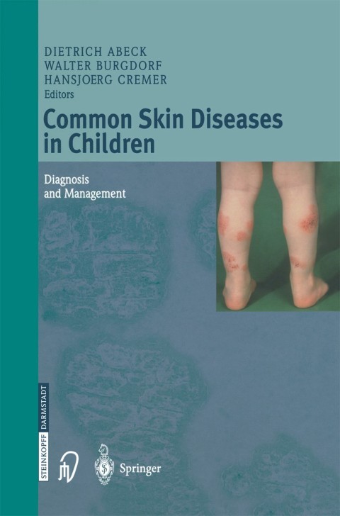 Cover image for book Common Skin Diseases in Children