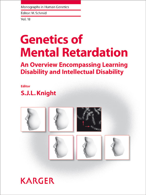Cover image for book Genetics of Mental Retardation