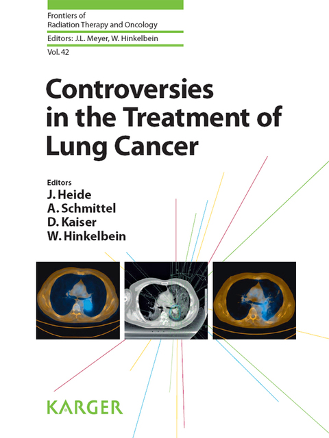 Cover image for book Controversies in the Treatment of Lung Cancer