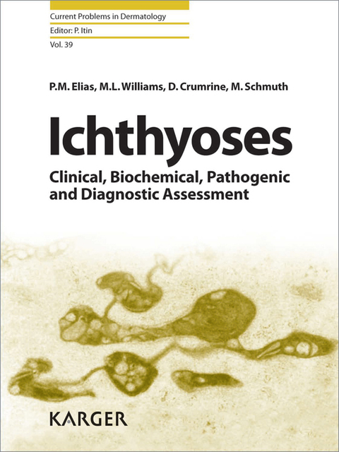 Ichthyoses 