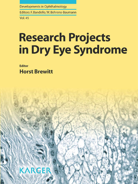 Cover image for book Research Projects in Dry Eye Syndrome