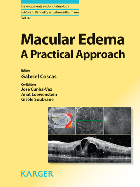 Cover image for book Macular Edema