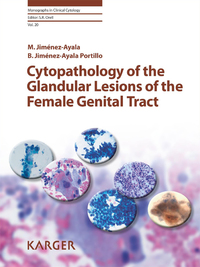Cover image: Cytopathology of the Glandular Lesions of the Female Genital Tract 9783805594646
