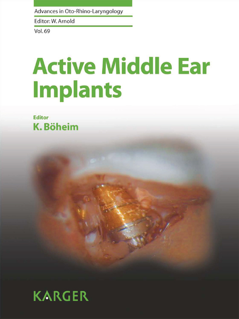 Cover image for book Active Middle Ear Implants