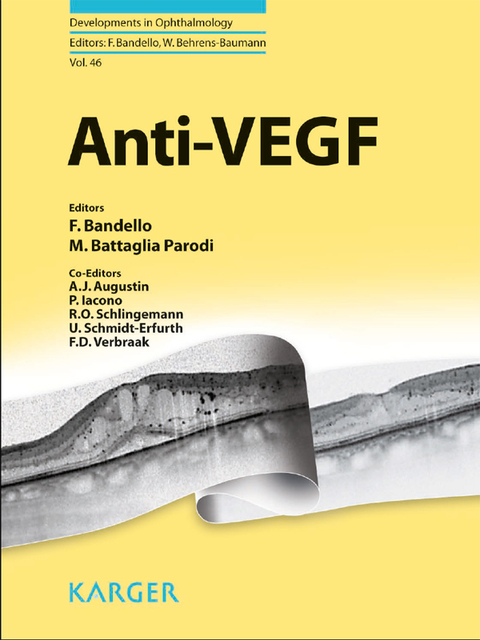 Cover image for book Anti-VEGF