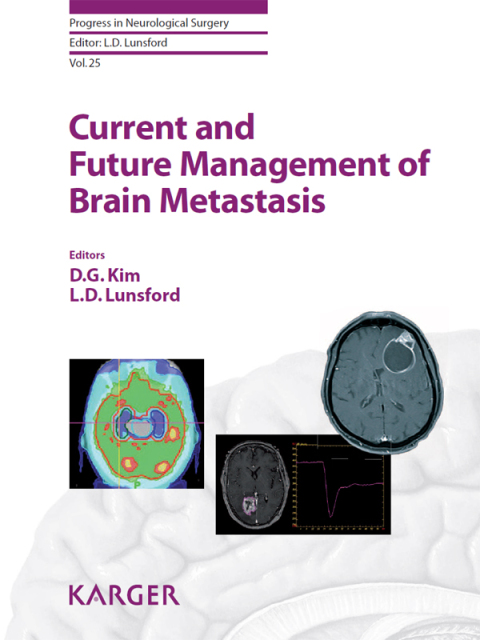 Cover image for book Current and Future Management of Brain Metastasis