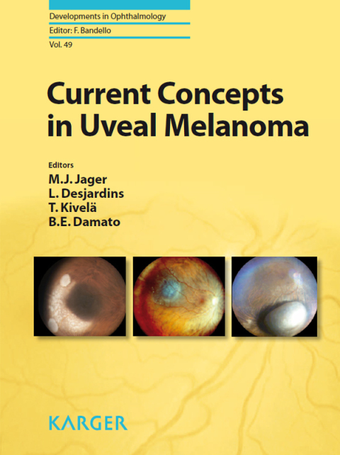 Cover image for book Current Concepts in Uveal Melanoma