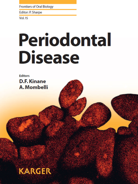 Cover image for book Periodontal Disease