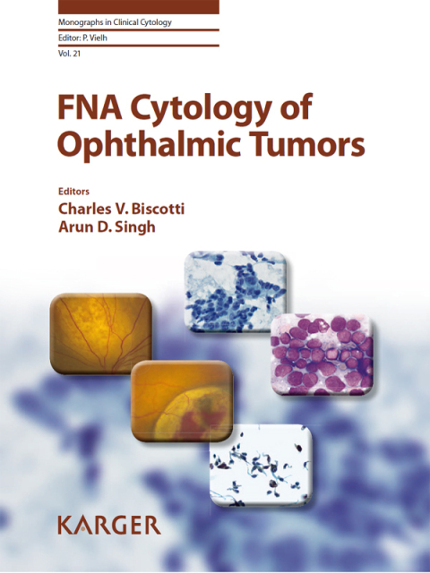 Cover image for book FNA Cytology of Ophthalmic Tumors