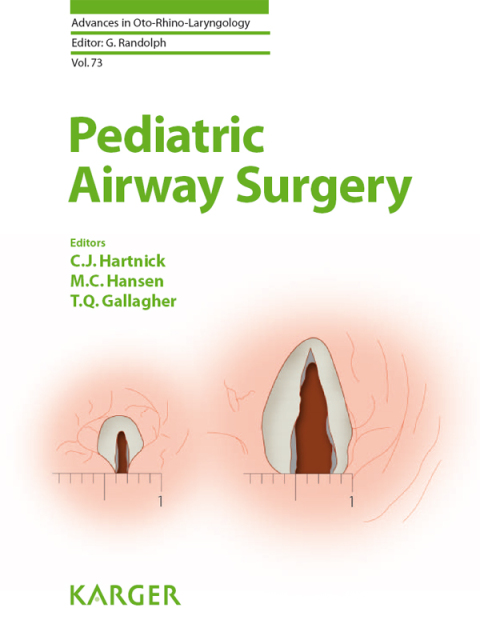 Cover image for book Pediatric Airway Surgery