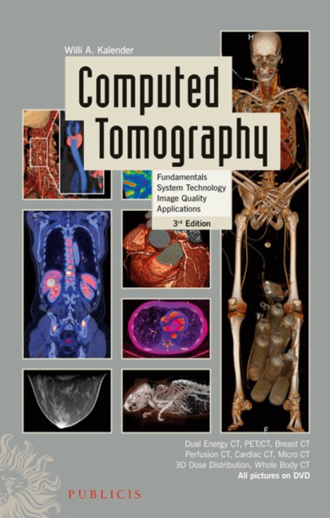 Cover image for book Computed Tomography: Fundamentals, System Technology, Image Quality, Applications