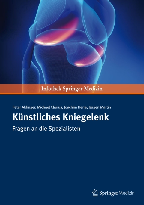 Cover image for book Künstliches Kniegelenk