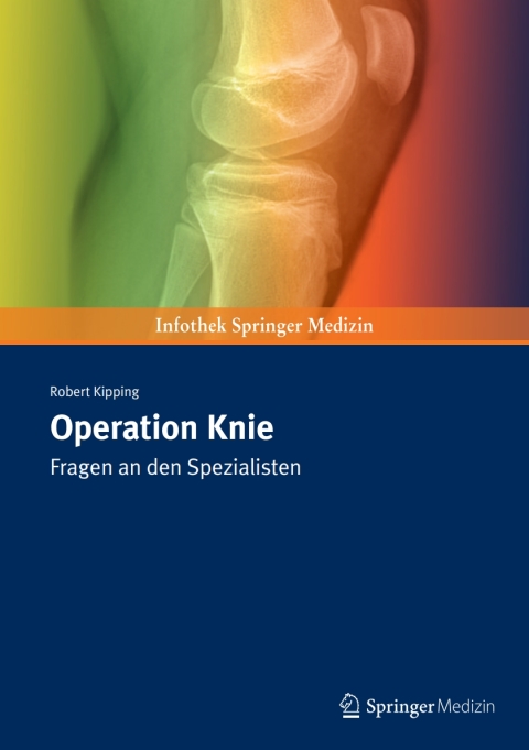 Cover image for book Operation Knie