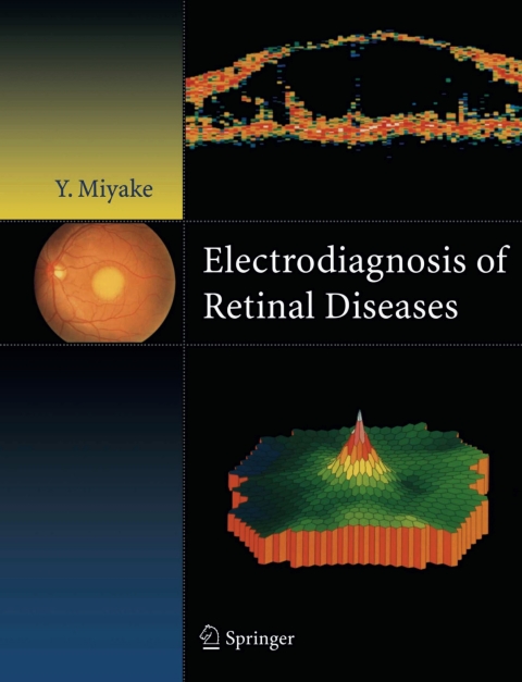 Cover image for book Electrodiagnosis of Retinal Disease