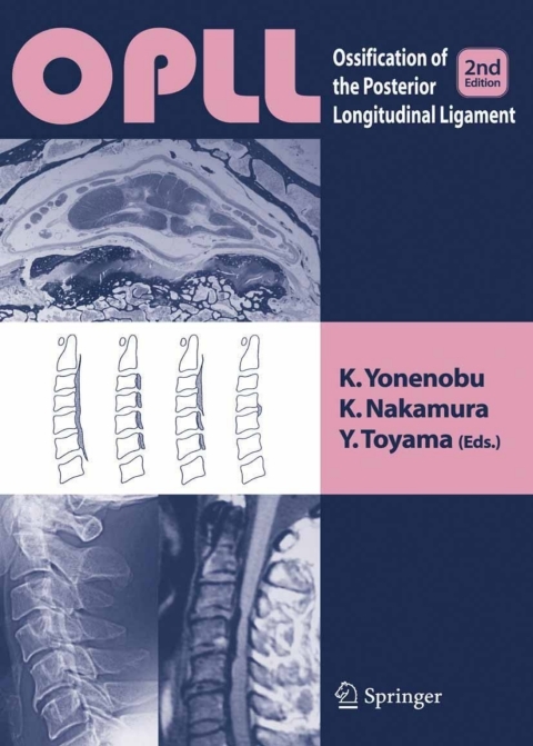 Cover image for book OPLL
