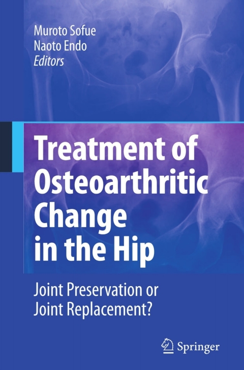 Cover image for book Treatment of Osteoarthritic Change in the Hip