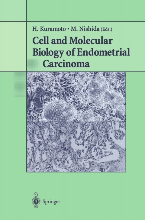Cover image for book Cell and Molecular Biology of Endometrial Carcinoma