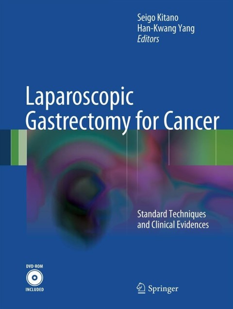 Cover image for book Laparoscopic Gastrectomy for Cancer