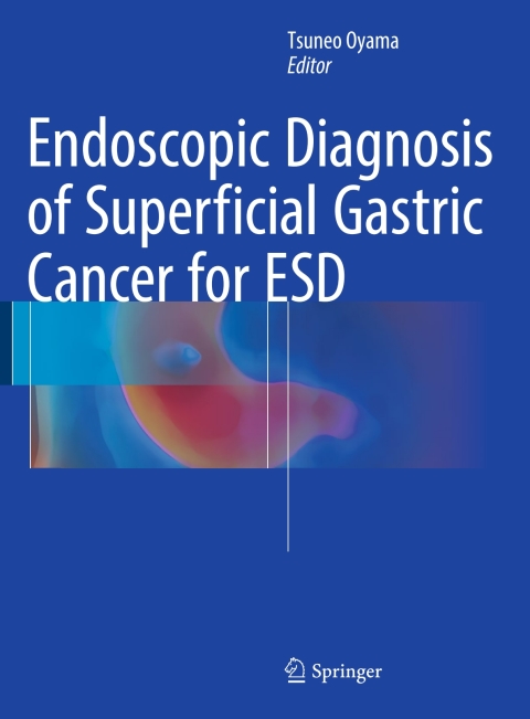 Cover image for book Endoscopic Diagnosis of Superficial Gastric Cancer for ESD